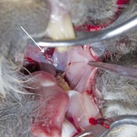 Occasionally a spur on the tooth can perforate a major blood vessels in the mouth and cause fatal haemorrhage. In this case the buccal artery had been perforated by a sharp spur on the tooth that had torn the mucosa (arrow). A large blood clot was occluding the pharynx.