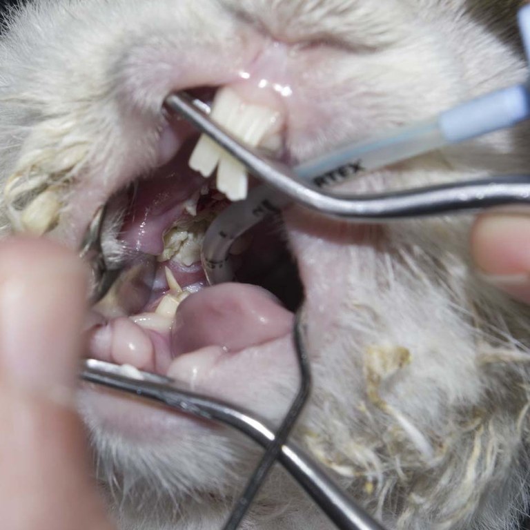 Dental spur causing an abscess