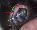 Arrows to abnormal areas of glaucomatous eye