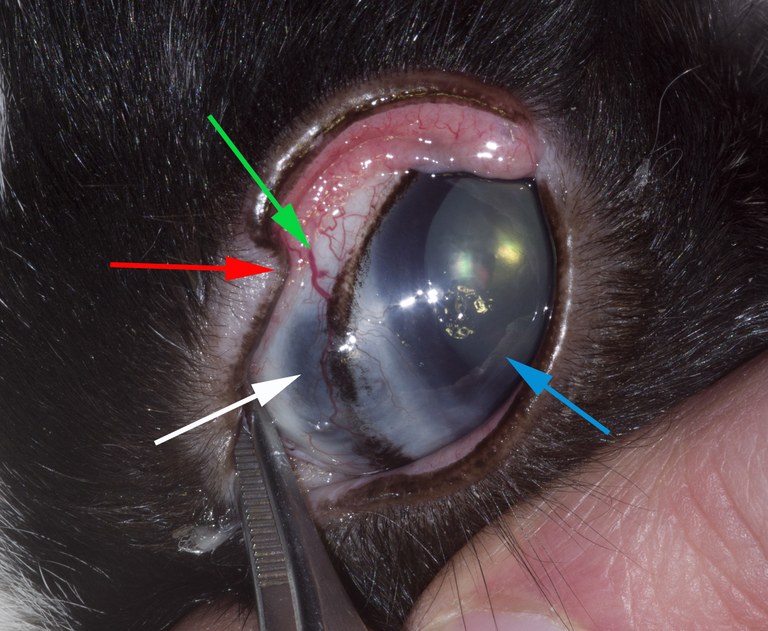 Arrows to abnormal areas of glaucomatous eye