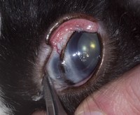 There is an area of pigmentation at the scleral junction that could be due to melanoma or staphyloma.  A staphyloma is a protrusion of uveal tissue (contents of the eyeball).  It is seen in association with glaucoma where globe enlargement stretches and thins the tissues. Scleral atrophy occurs at the limbus and allows uveal tissue to protrude. 