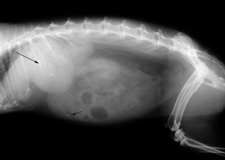 Lead poisoning first radiograph