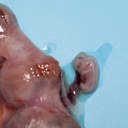 Embryo in viable foetal unit